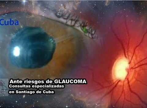 Ante riesgos de Glaucoma, especialistas en Santiago de Cuba tienen respuestas actualizadas. Foto: Santiago Romero Chang