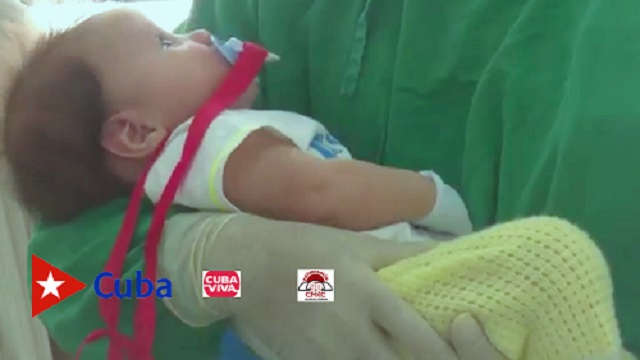 Santiago de Cuba: edades pediátricas entre las más sensibles a Covid-19