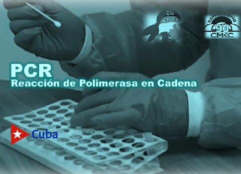 PCR, es la abreviatura de Reacción de Polimerasa en Cadena. Imagen WEB: Santiago Romero Chang