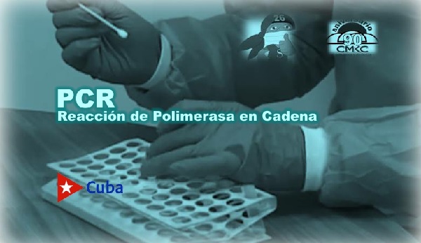 PCR, es la abreviatura de Reacción de Polimerasa en Cadena. Imagen WEB: Santiago Romero Chang